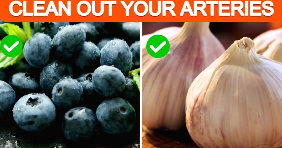 5 Amazing Foods That Can Clean Your Arteries Naturally and Prevent Heart Attack