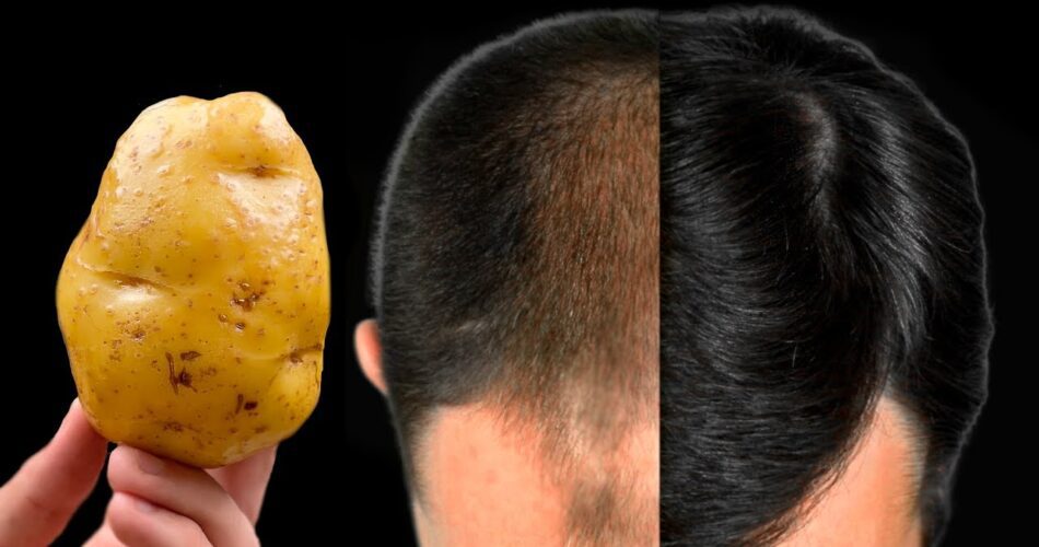 If you’re looking for a natural way to boost hair growth and stop hair from falling out, look no further than the humble potato. Potatoes are rich in nutrients that can strengthen your hair, promote growth, and reduce hair loss. This simple, powerful remedy has been a well-kept secret for achieving thick, healthy hair. Why Potatoes Are So Effective for Hair Growth Rich in Vitamins and Minerals: Potatoes are packed with essential nutrients like vitamins B and C, iron, zinc, and niacin. These nutrients nourish the hair follicles, promote scalp health, and help in the regeneration of hair cells. Boosts Collagen Production: The vitamin C in potatoes helps boost collagen production, which is vital for hair growth and strength. It supports the structure of the hair shaft and promotes longer, healthier hair. Fights Hair Loss: Potatoes contain natural compounds that help reduce hair fall by strengthening the roots and improving blood circulation to the scalp. How to Use Potato for Hair Growth Here’s how you can use potato juice to create a simple and effective hair mask: Ingredients: 1 large potato 1 tablespoon of honey (optional for extra moisture) 1 tablespoon of aloe vera gel (optional for soothing the scalp) Instructions: Peel and grate the potato, then squeeze the juice from the grated potato using a cheesecloth or a strainer. Mix the potato juice with honey and aloe vera gel for added benefits. Massage the mixture into your scalp, ensuring that it covers the roots and hair strands. Leave it on for 20-30 minutes, then rinse your hair with lukewarm water. Use this remedy 2-3 times a week for best results. Benefits of Using Potato for Hair Promotes Faster Hair Growth: The nutrients in potato juice nourish the scalp and hair follicles, stimulating hair growth and making your hair grow stronger and faster. Reduces Hair Loss: By strengthening the hair at the root, potato juice helps reduce hair fall and encourages thicker, fuller hair. Adds Shine and Softness: Potato juice helps to restore shine and smoothness to your hair, making it look healthier and more vibrant. The Strongest Natural Remedy for Hair Growth This potato hair mask is one of the most powerful natural remedies for hair growth and preventing hair loss. It’s easy to make, uses ingredients you probably already have at home, and can give you the thick, luscious hair you’ve always wanted. Try it out and see the results for yourself—your hair will thank you!