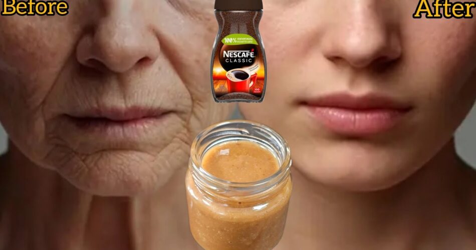 How Coffee Can Boost Collagen and Reduce Wrinkles