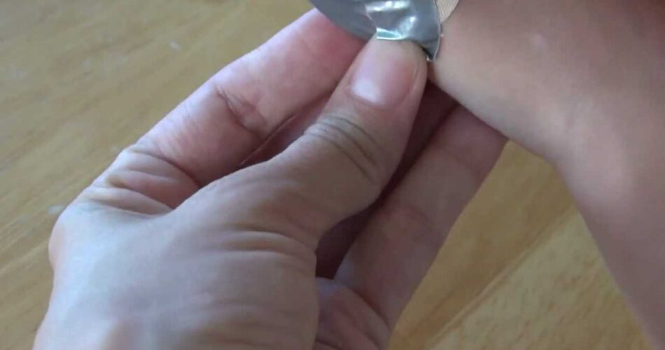 How to Get Rid of Warts Using Apple Cider Vinegar