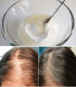 Baking Soda Shampoo Will Make Your Hair Grow Faster Than Ever