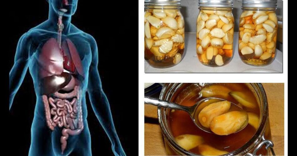 Eating Garlic And Honey On An Empty Stomach