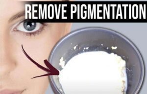 How to Get Rid of Pigments on the Face Using Natural Ingredients