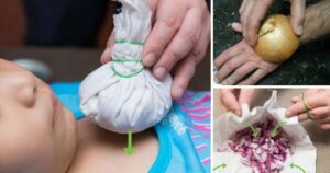 No One ever Told You Onions Could Do these Miraculous Things