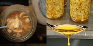 Natural Remedies for Flu and Colds A Friendlier Approach for a More Comfortable Recovery