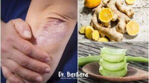 Strengthen Your Immune System and Battle Bacteria and Fungi Naturally!