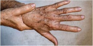 Unveil the Secret The No. 1 Mineral for Clearing Age Spots