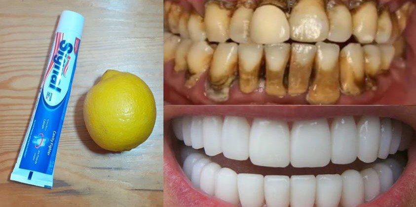 Brighten Your Smile with a Simple Homemade Toothpaste