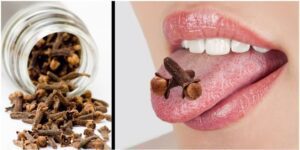 Winning the Battle Against Tartar 10 Natural Strategies