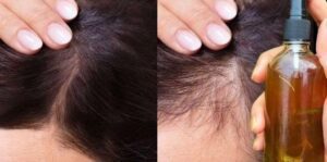 Nature’s Trio Homemade Remedy for Luxurious Locks