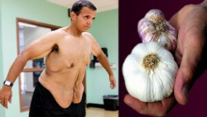 The Power Duo Garlic and Ginger for Belly Fat Reduction