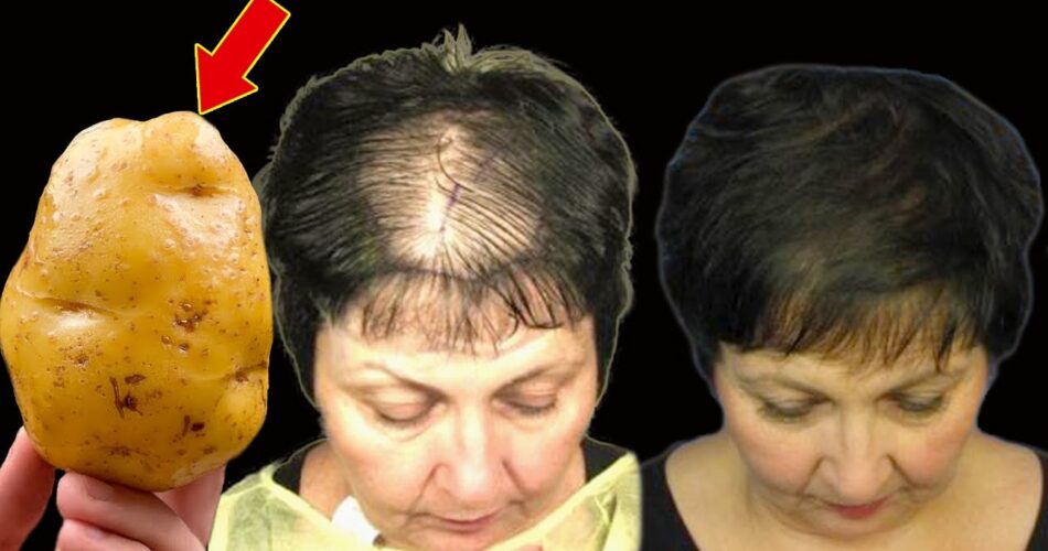 Hair Grows Like Crazy and Doesn’t Fall Out! Discover the Powerful Potato Recipe