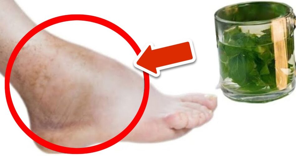 Parsley Tea A Natural Remedy for Reducing Swelling in Feet and Legs