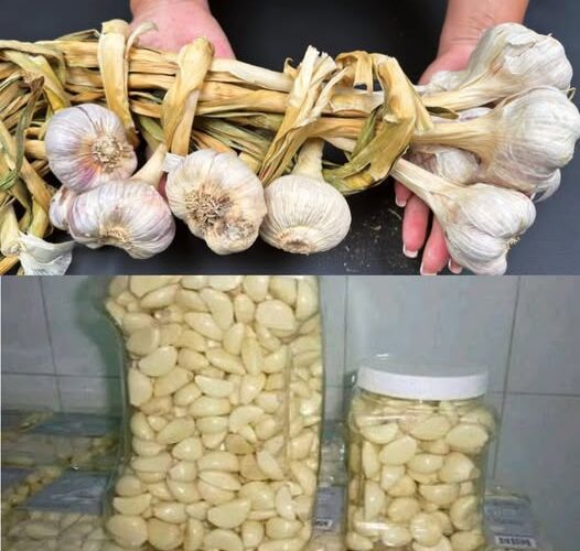 All Toxins Disappear in 3 Days! Detox Your Liver Naturally with Grandma’s Garlic Recipe