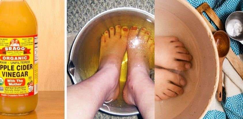 DIY Baking Soda Pedicure Say Goodbye to Foot Problems!