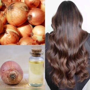Discover the Magic of Onion Hair Oil