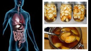 Eating Garlic And Honey On An Empty Stomach