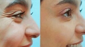 Magic Homemade Facial Cream That Erases Wrinkles From Your Face Better Than Expensive Cosmetics