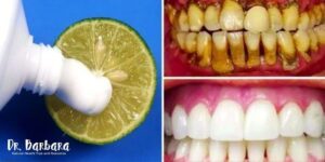Brighten Your Smile Naturally The Two-Minute Lemon Whitening Method