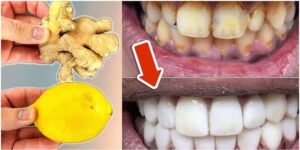 Brighten Your Smile with Simple Home Remedies