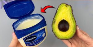 The Surprising Beauty Secret Vaseline and Avocado Blend for Radiant Skin