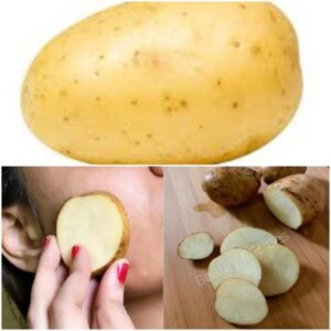Discover the Power of Potatoes for Your Skin!