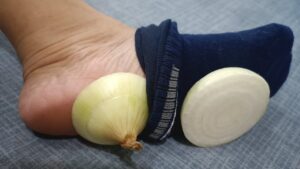The Surprising Benefits of Sleeping with Onions in Your Socks