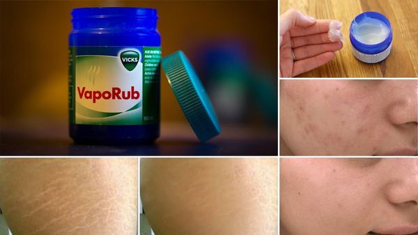 8 Surprising Uses of Vicks VapoRub!!