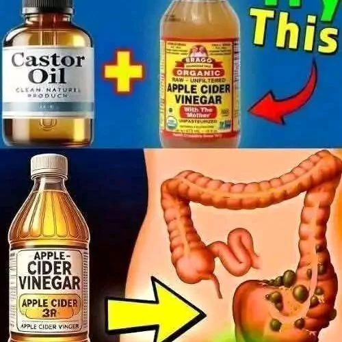 Discover the Magic of Castor Oil and Apple Cider Vinegar